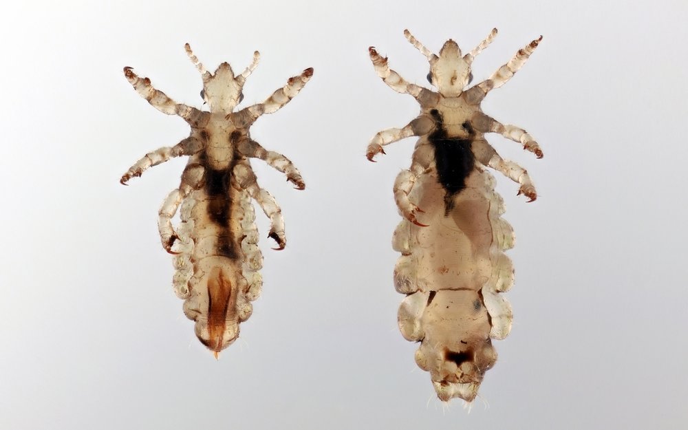 Ein Insekt mit schwacher Lobby: die Kopflaus.