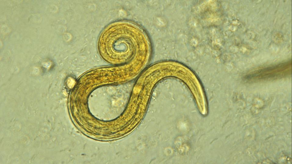 Der Lungenwurm &lt;i&gt;Aelurostrongylus abstrusus&lt;/i&gt; unter dem Mikroskop.
