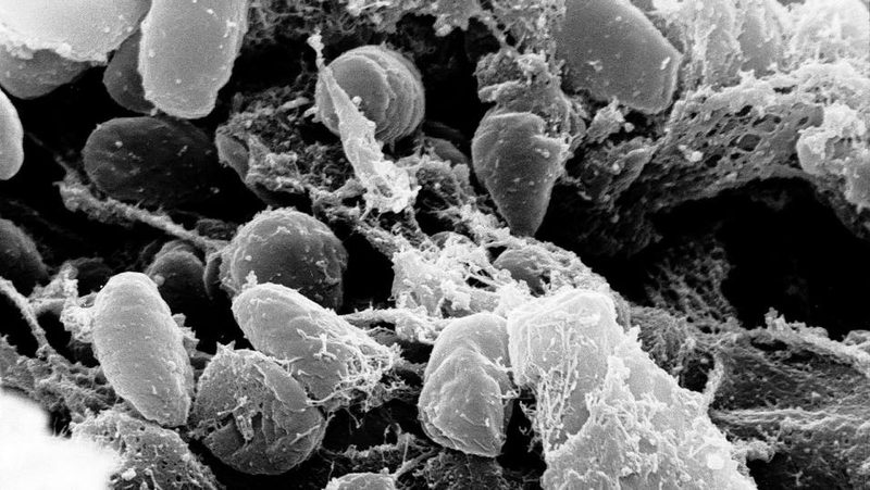 Yersinia pestis unter dem Elektronenmikroskop