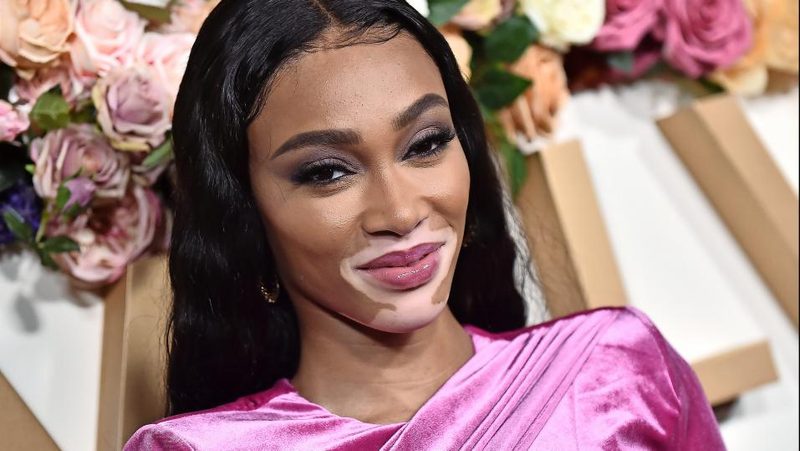 Winnie Harlow