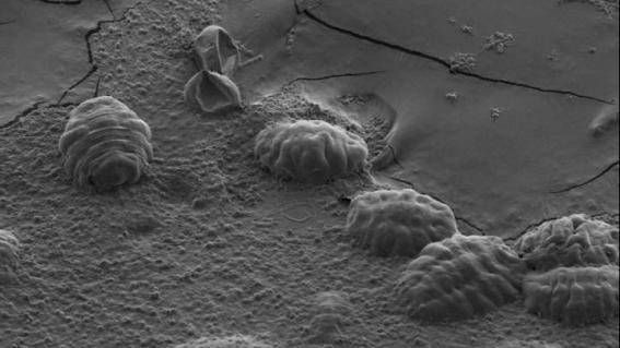 Elektronenmikroskopaufnahme von Bärtierchen in dehydriertem Zustand